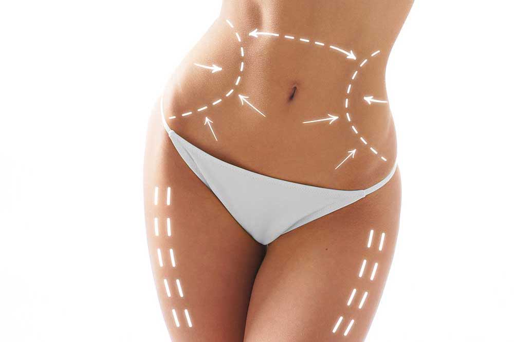 A woman 's body with lines drawn on it.